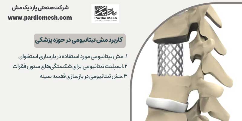 کاربرد مش تیتانیومی در حوزه پزشکی | پاردیک مش