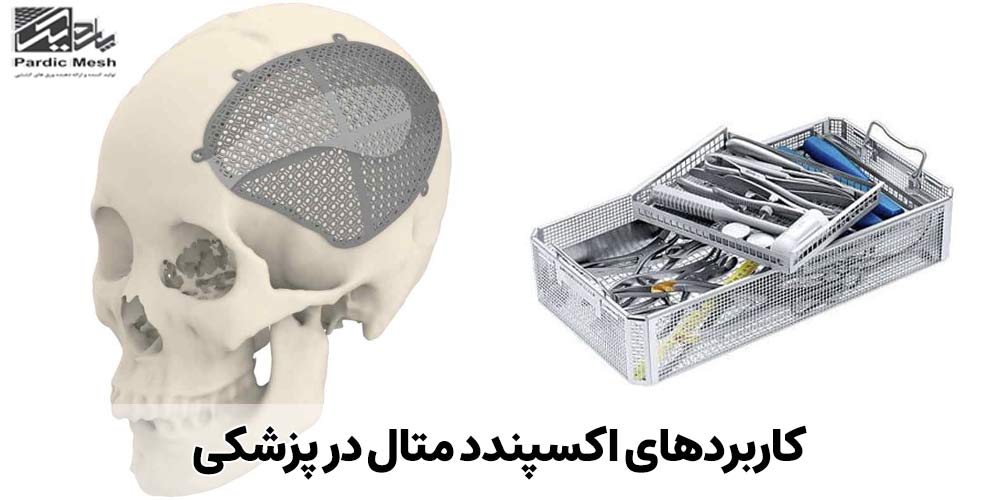 کاربردهای اکسپندد متال در پزشکی | پاردیک مش